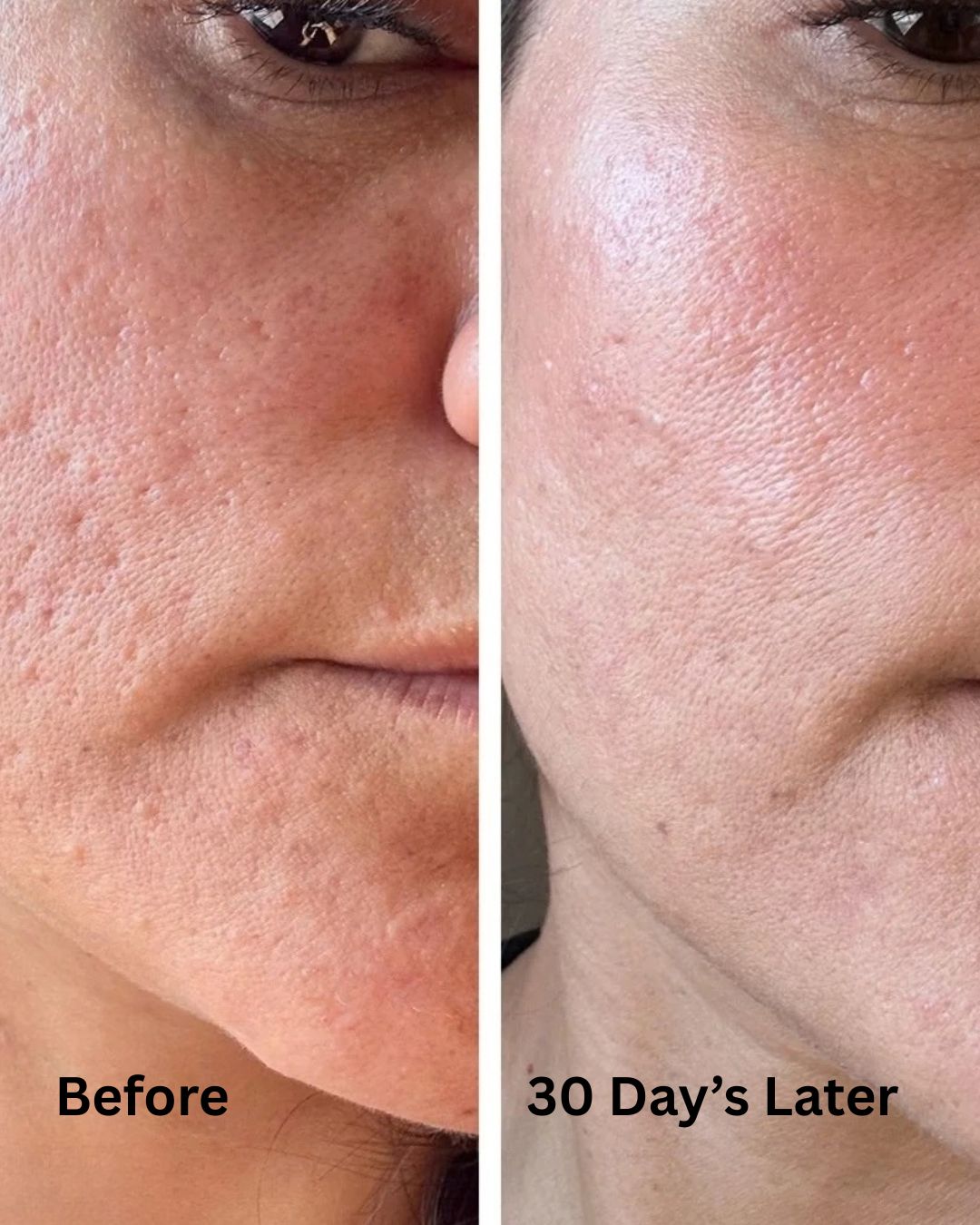 Hydrated, Healthy, Tighter Skin in just 30 Days - Collagen Revitalising System