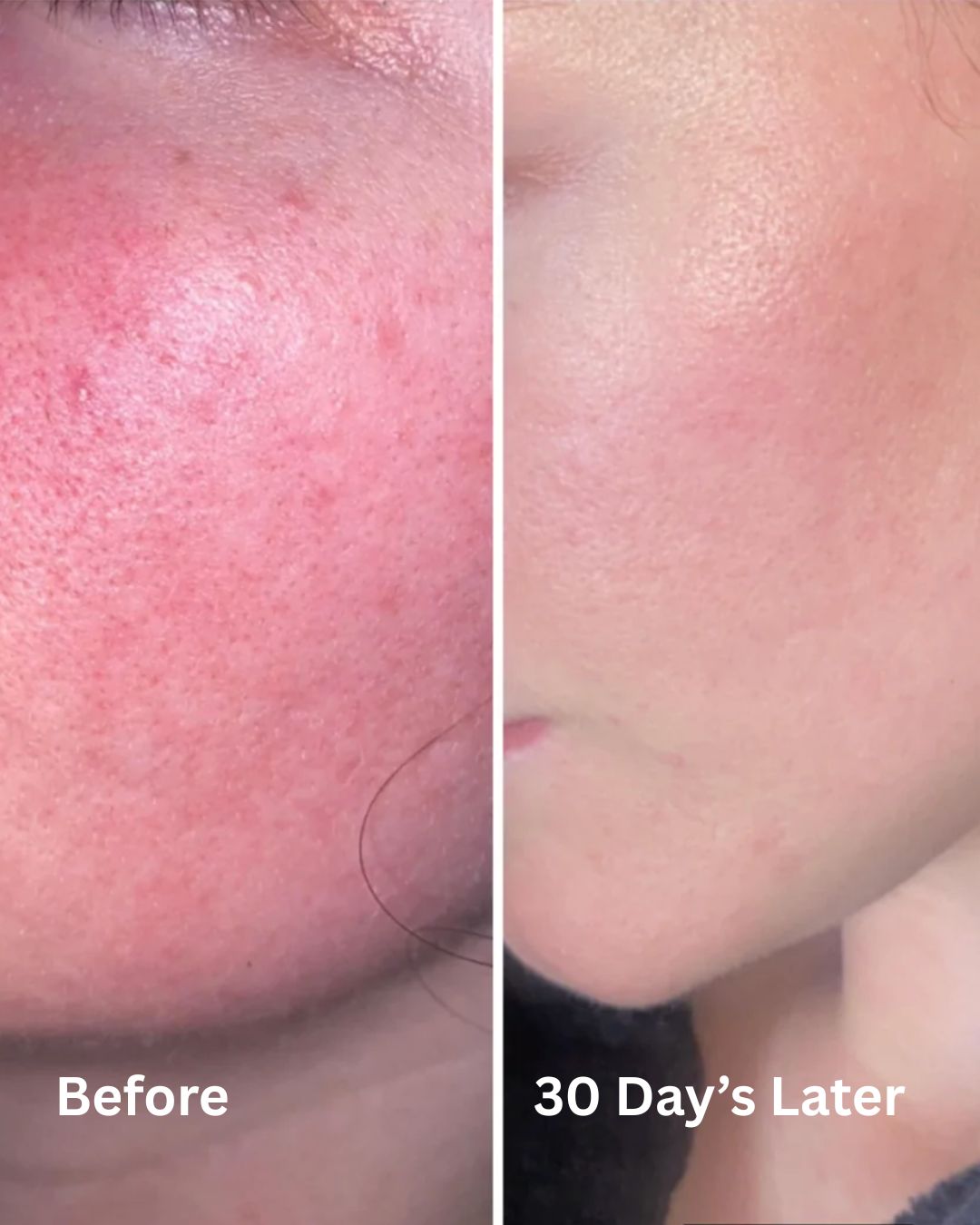 Hydrated, Healthy, Tighter Skin in just 30 Days - Collagen Revitalising System